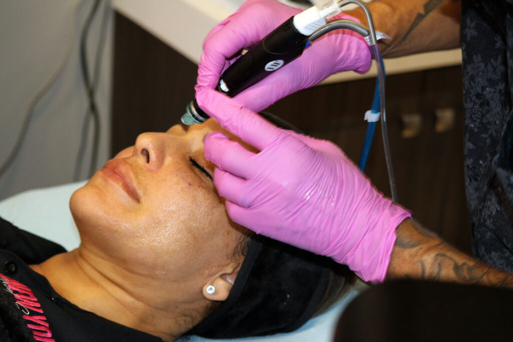 Hydrafacial® Treatment