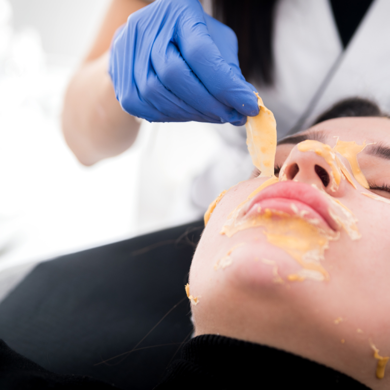 chemical-skin-peel-treatment