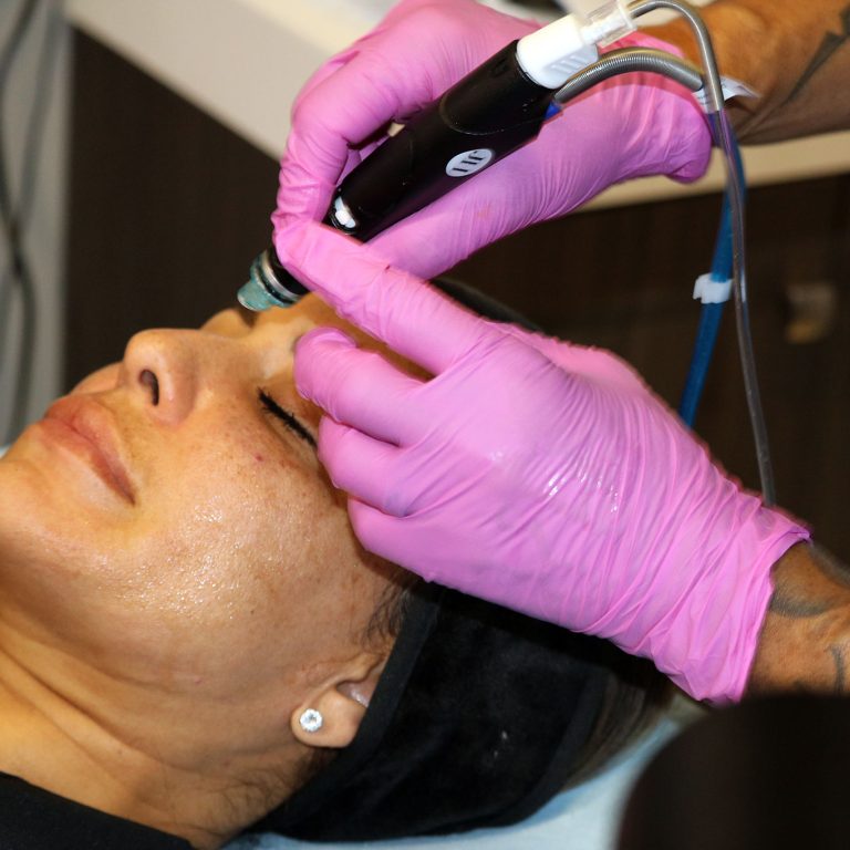 Hydrafacial® Treatment