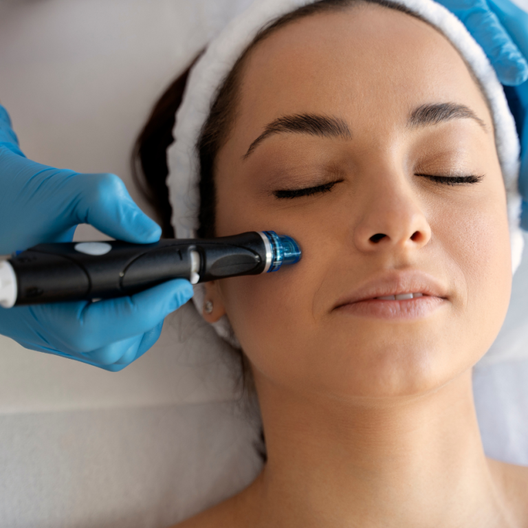microdermabrasion-orange-county